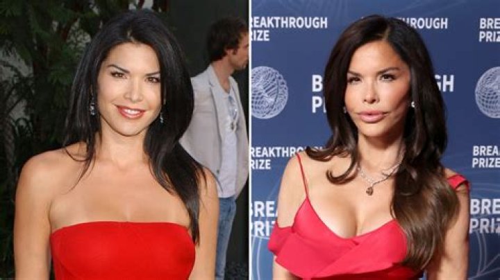 Did Jeff Bezos fiancee undergo plastic surgery? ·