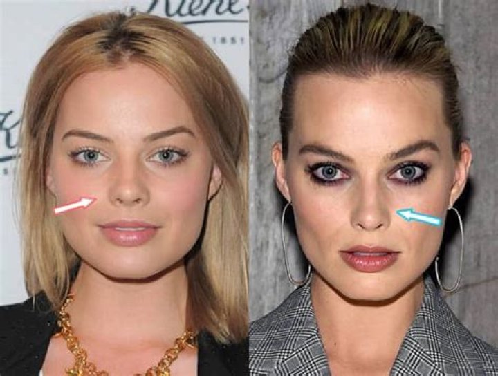 Margot Robbie Botox And Nose Job Did She Get Surgery? Before And After