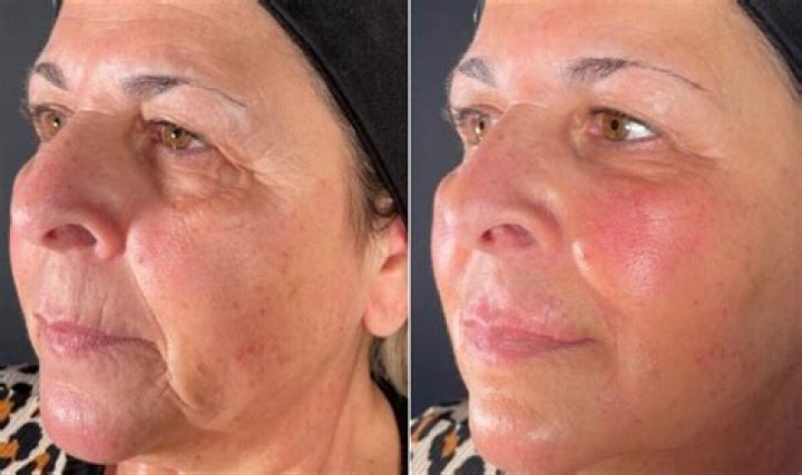 She Looks Older.. Those Wrinkles Still Going Through Break Up With GerardPique, 46Y ·